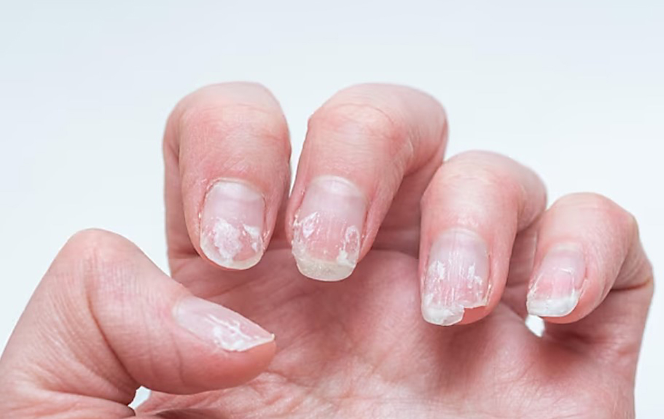 Помилки в манікюрі, через які у вас "відпадуть" нігті